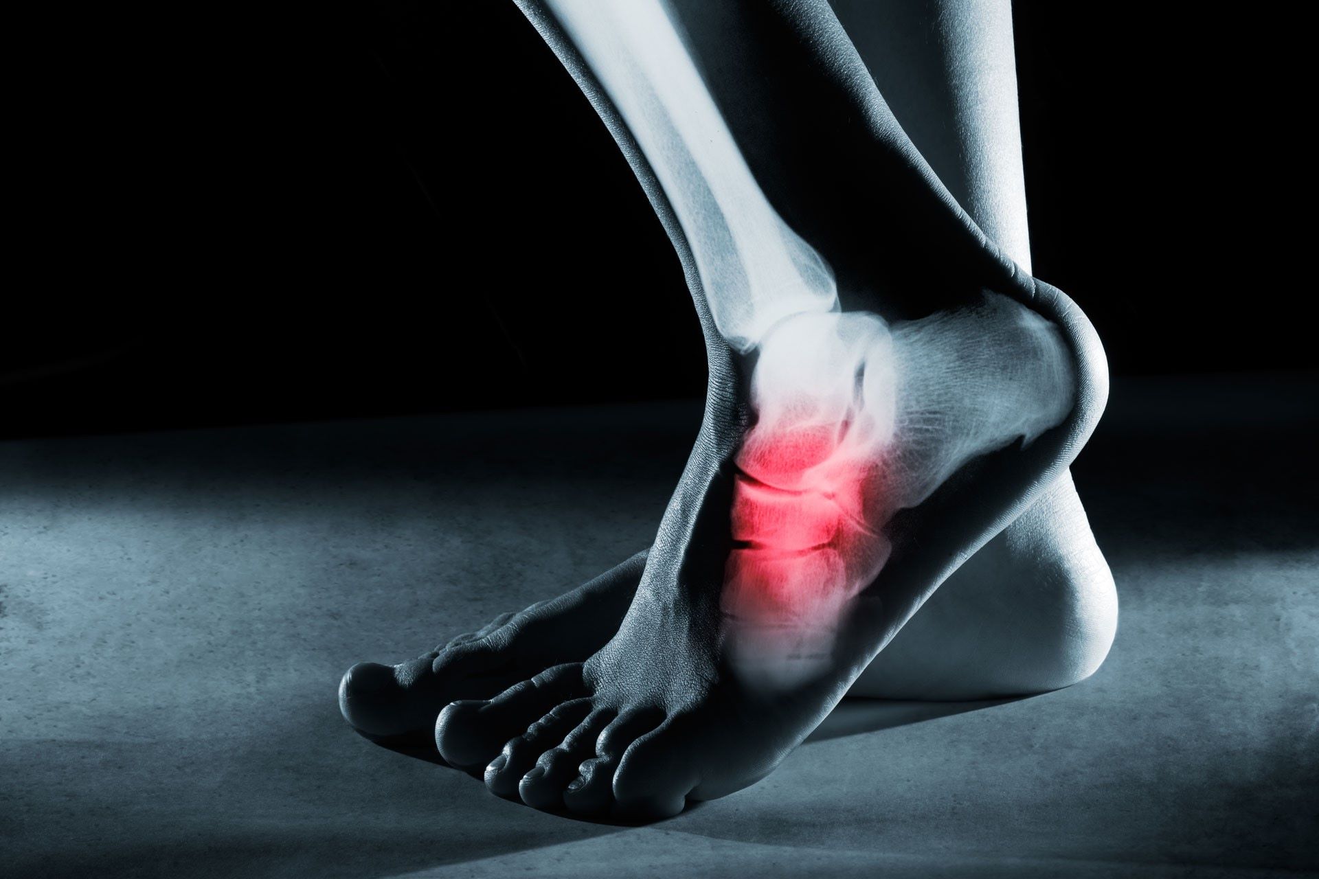 4 Common Foot Injuries To Be Aware Of When Running
