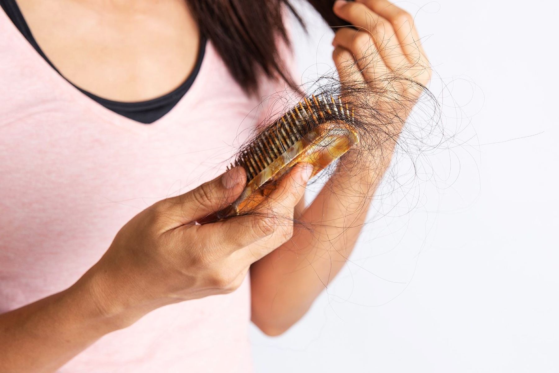 The Connection Between Obesity And Hair Loss: What You Should Understand