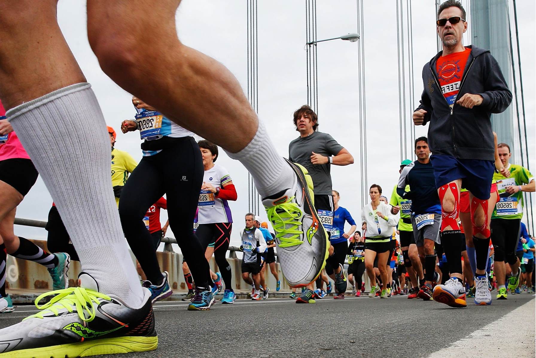 Running A Marathon With One Kidney: Is It Safe?
